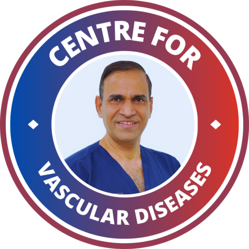 Dr. Devender Singh - Best Vascular Surgeon in Hyderabad